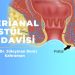 Perianal Fistul Belirtileri ve Tedavisi
