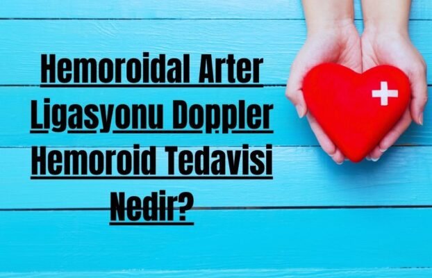 Hemoroidal Arter Ligasyonu Doppler Hemoroid Tedavisi Nedir?