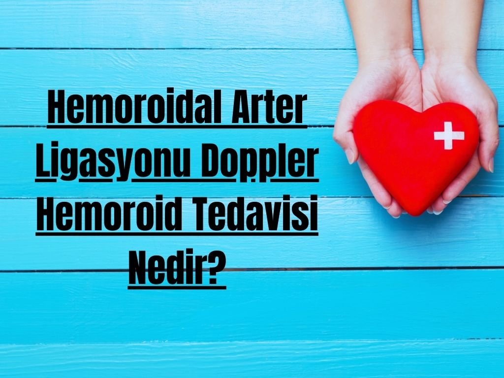 Hemoroidal Arter Ligasyonu Doppler Hemoroid Tedavisi Nedir?