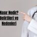 Nasır Nedir Belirtileri ve Nedenleri
