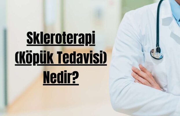 Skleroterapi (Köpük Tedavisi) Nedir?