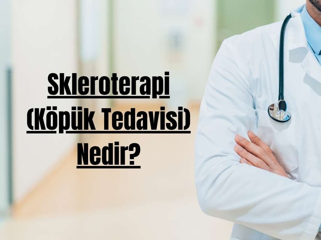 Skleroterapi (Köpük Tedavisi) Nedir?