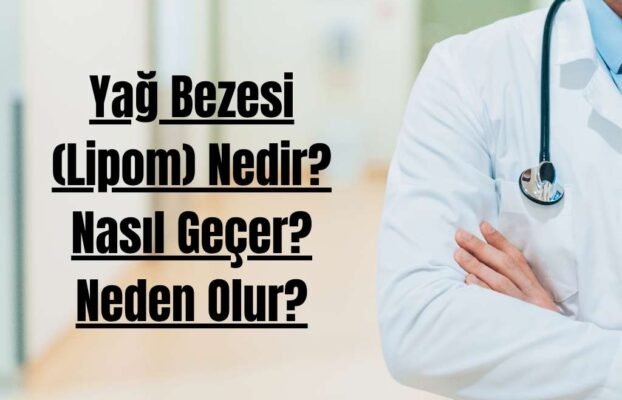 Yağ Bezesi (Lipom) Nedir? Nasıl Geçer? Neden Olur?