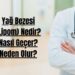 Yağ Bezesi (Lipom) Nedir Nasıl Geçer Neden Olur