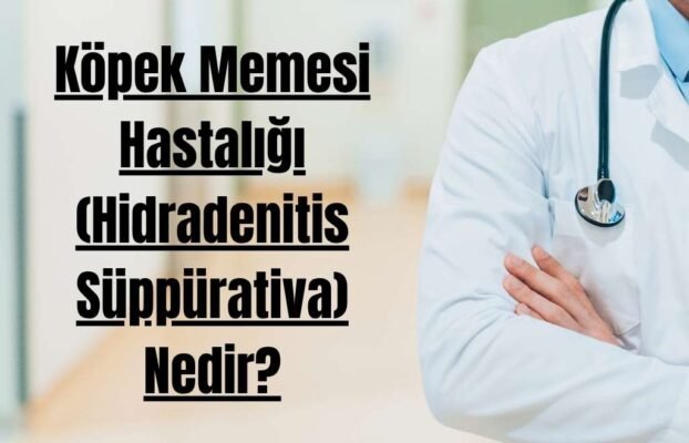 Köpek Memesi Hastalığı (Hidradenitis Süppürativa) Nedir?