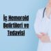 İç Hemoroid Belirtileri ve Tedavi Seçenekleri