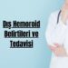 Dış Hemoroid Belirtileri ve Tedavisi